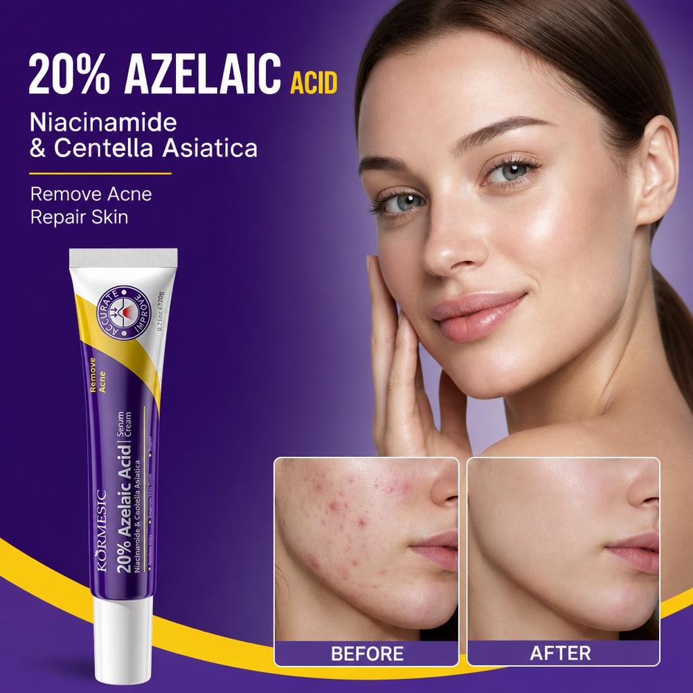 20% Azelaic Acid essence Deep  - огляд і ціна Luxury Skincare Brands
